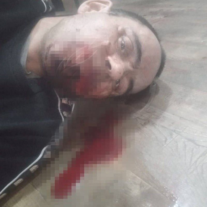 В Башкирии жестоко избили ветерана СВО из-за его заявлений в полицию на иностранного специалиста из Азербайджана — СМИ В Башкирии жестоко избили ветерана СВО из-за его заявлений в полицию на иностранного специалиста из Азербайджана — СМИ