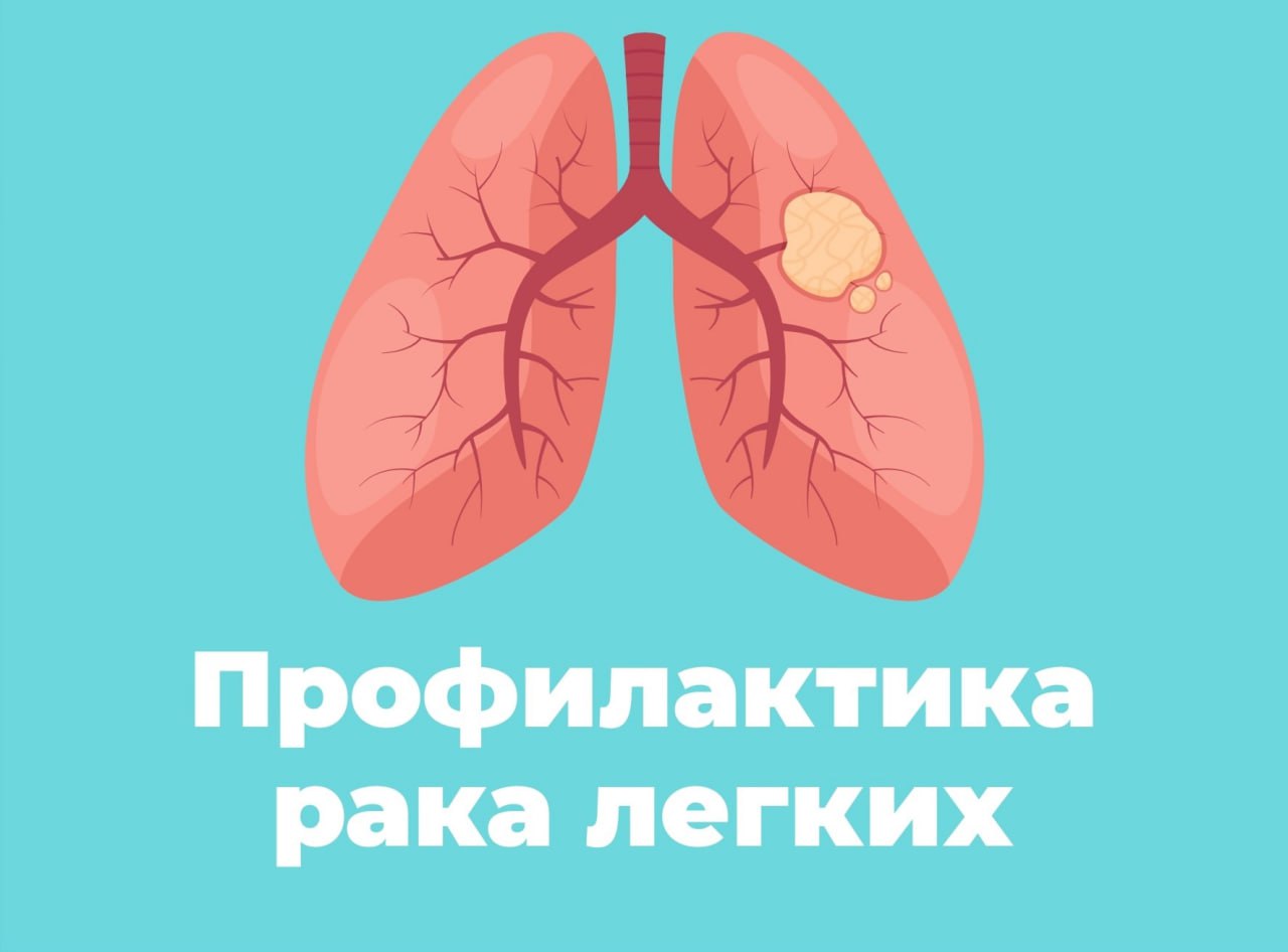 3-9 НОЯБРЯ НЕДЕЛЯ ПРОФИЛАКТИКИ РАКА ЛЕГКИХ