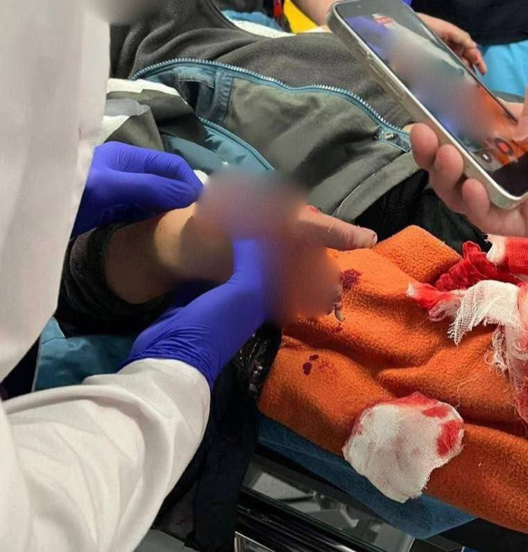 В Красногорске возбуждено уголовное дело по факту совершения общеопасным способом покушения на убийство ребенка