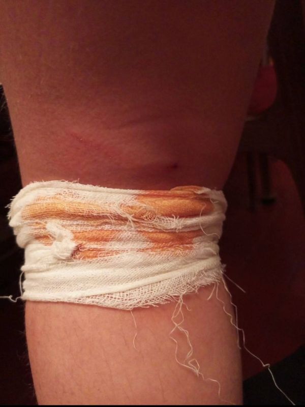 Бродячие стаи собак на Донбассе кидаются на людей Бродячие стаи собак на Донбассе кидаются на людей
