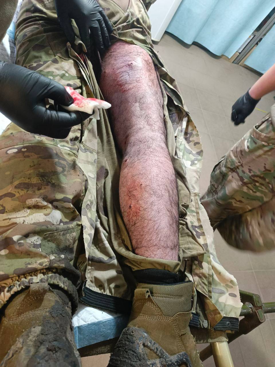 Александр Сладков: Вот судьба человека. Мы работали в Пятой бригаде, познакомились с бойцом, зовут Диран Александр Сладков: Вот судьба человека. Мы работали в Пятой бригаде, познакомились с бойцом, зовут Диран