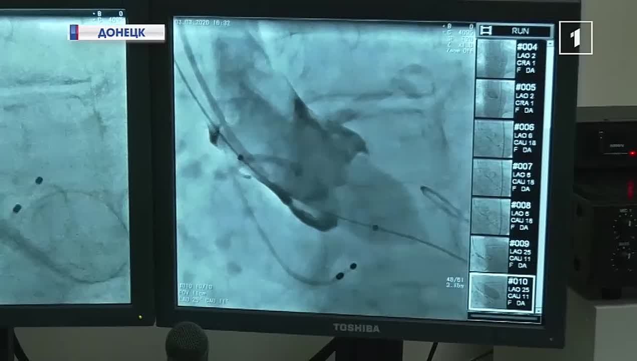 Донецкие кардиохирурги осваивают передовые технологии в проведении операций на сердце