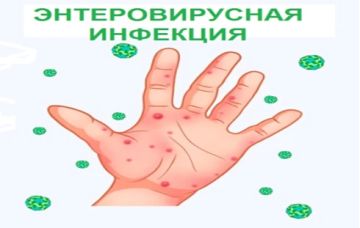 Острые кишечные/ротавирусные инфекции: крупные вспышки, меры предупреждения
