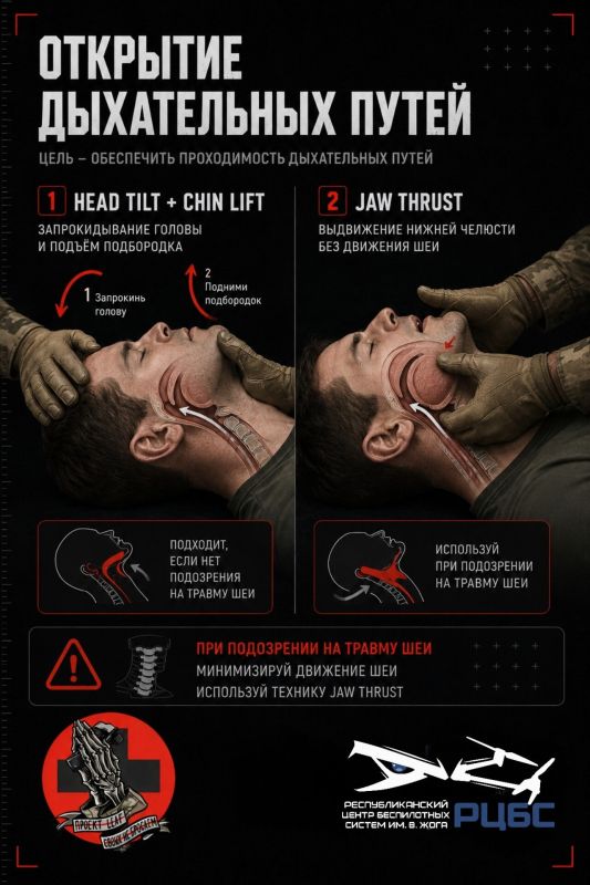 MARCH: A - AIRWAY. После остановки массивного кровотечения переходим к следующему этапу алгоритма MARCH - A (Airway), проходимость дыхательных путей MARCH: A - AIRWAY. После остановки массивного кровотечения переходим к следующему этапу алгоритма MARCH - A (Airway), проходимость дыхательных путей