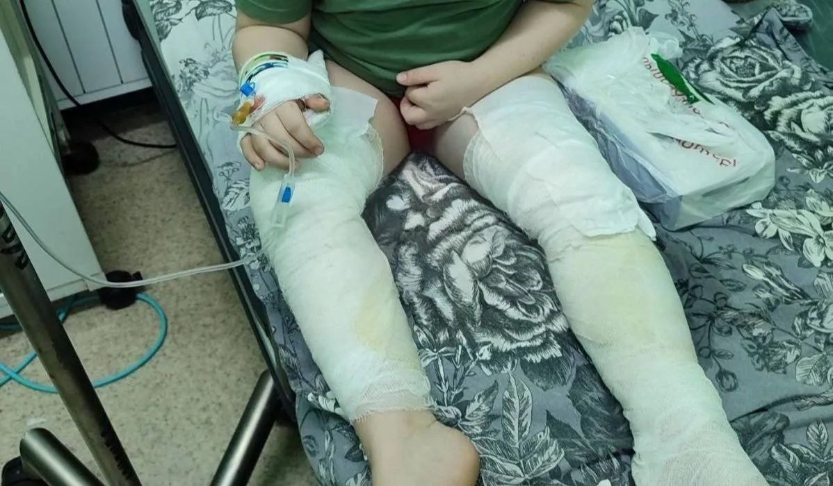 Только спустя полтора года в ДНР нашли виновных в инциденте в донецкой маршрутке №11, в результате которого 5-летнего мальчика и его мать обожгло тосолом Только спустя полтора года в ДНР нашли виновных в инциденте в донецкой маршрутке №11, в результате которого 5-летнего мальчика и его мать обожгло тосолом